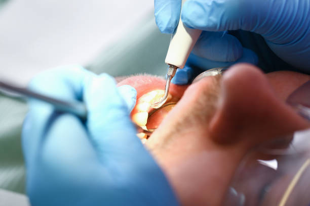 Best Walk-In Emergency Dentist in Maryvle, IL