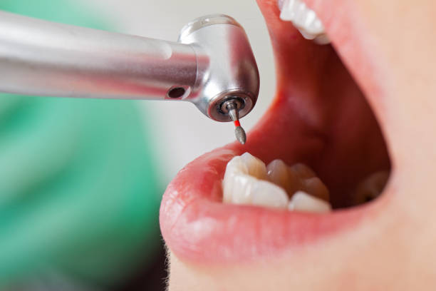Best Pediatric Emergency Dentist in Maryvle, IL